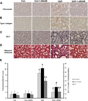 Soluble receptors for advanced glycation end-products prevent unilateral ureteral obstruction-induced renal fibrosis